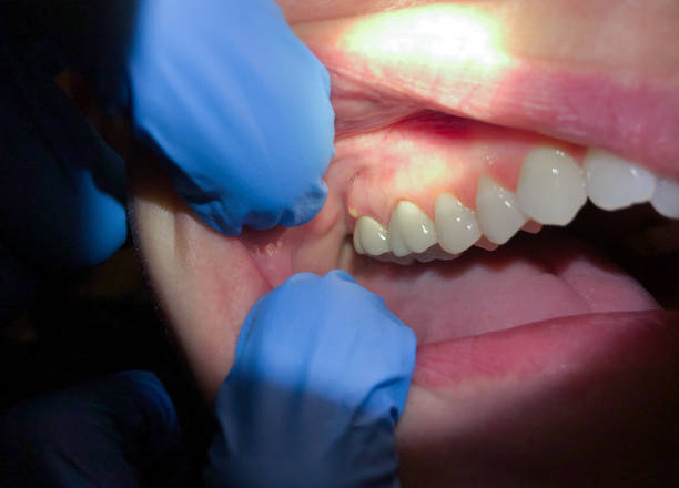Best Tooth Infection Emergency Dentist  in Hoffman Estates, IL