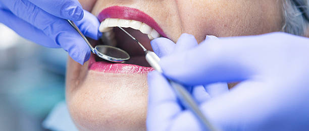 Best Knocked-Out Tooth Emergency  in Hoffman Estates, IL